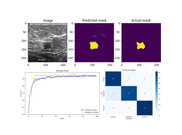 Breast ultrasound – segmentation & hybrid classification