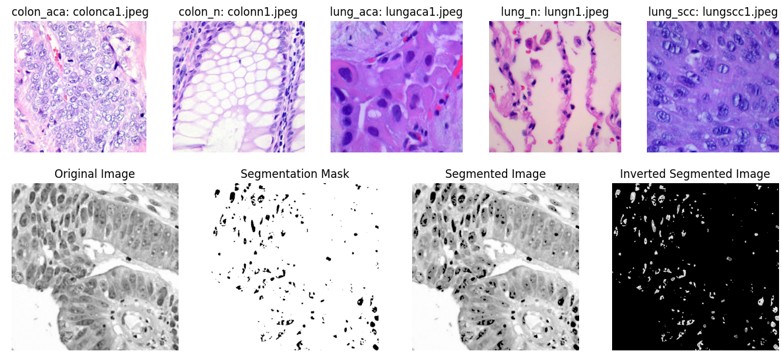 Lung–Colon project overview