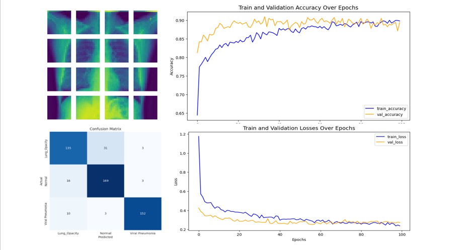 Vision Transformer project overview 